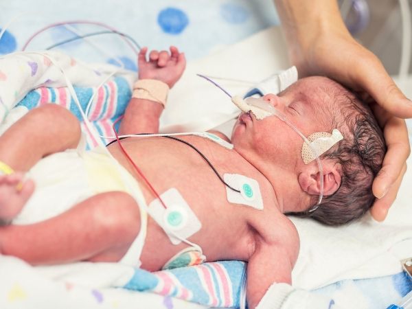 Neonatal clinical guidelines, protocols, pathways, and algorithms for respiratory management.