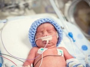 NICU Surfactant Delivery Guidelines (vertical) - Neonatology Solutions